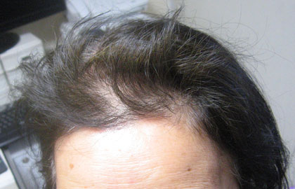 2011.02-式の後の髪